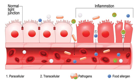 Leaky Gut (permeabilidad intestinal)